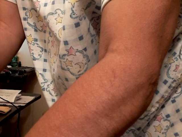 لقطات البث FIXMYASSTOO
