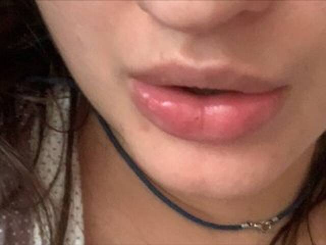 لقطات البث Rinaru555555